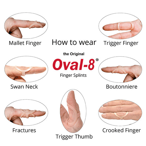 Finger Splint Sizer Kt 3 Point Products Oval 8 Splint Sizing Set